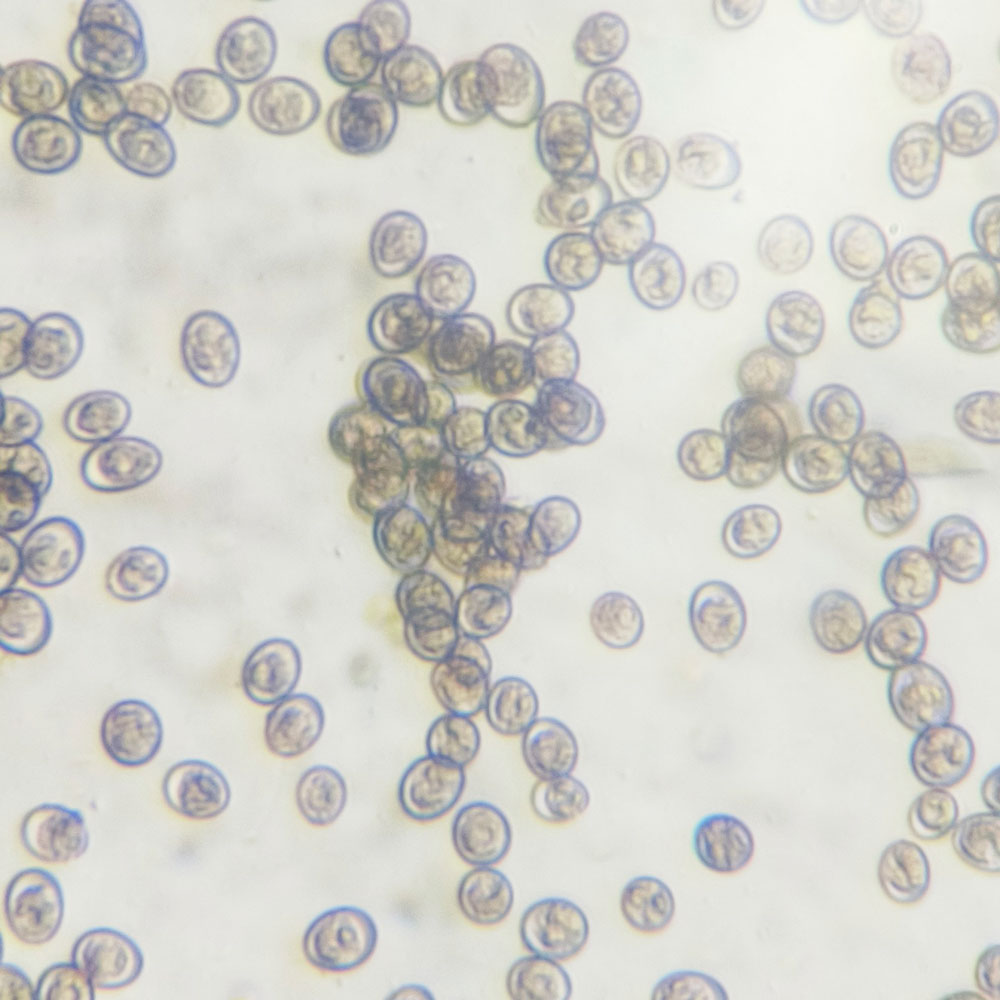 Microscopic view of coccidia oocysts,