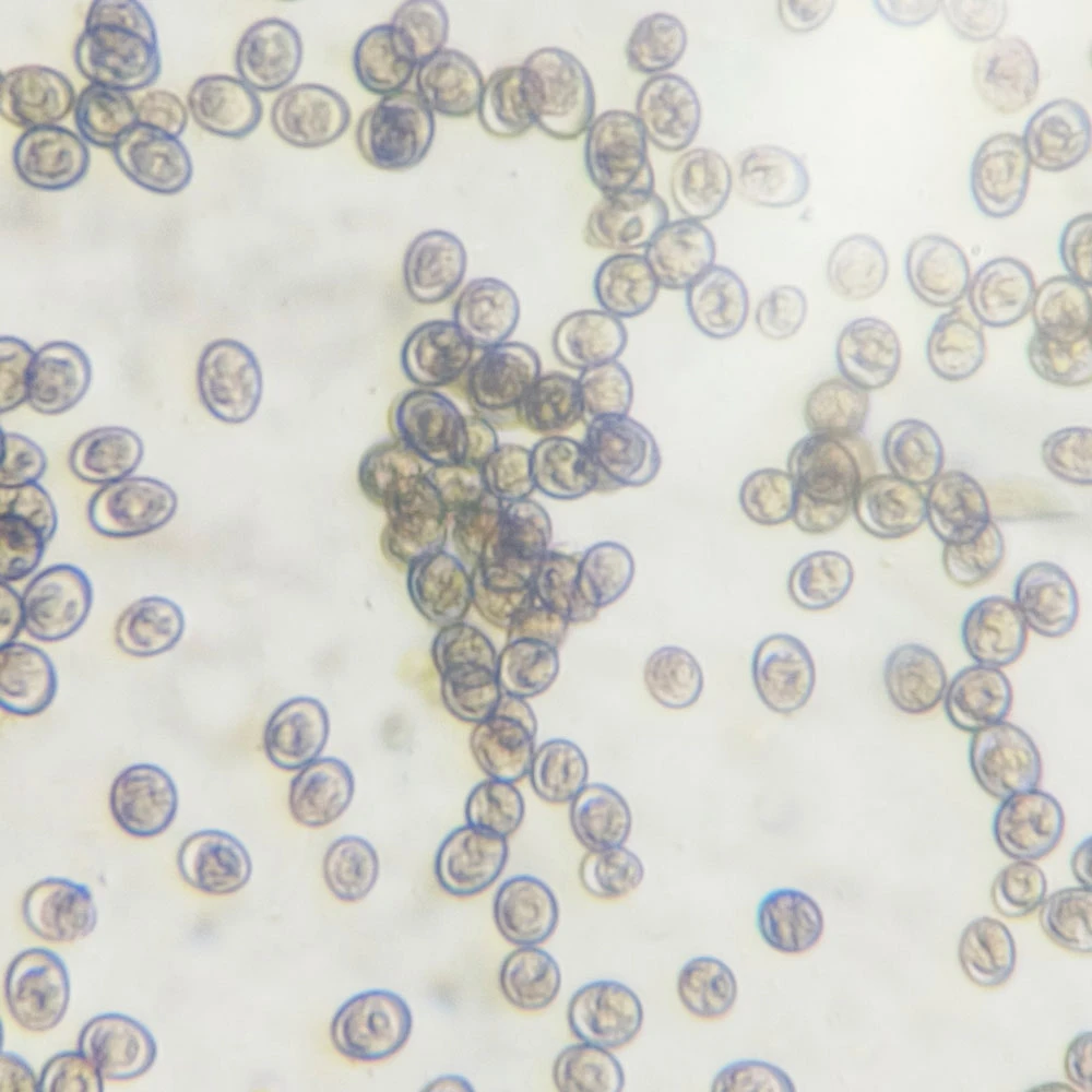 Microscopic view of coccidia oocysts,